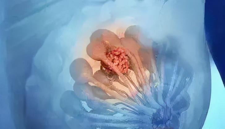 「科学体检全攻略」女性体检，注意这两点，少花钱少走弯路