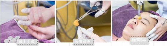 福州如何有效祛痘坑,福州快速祛痘