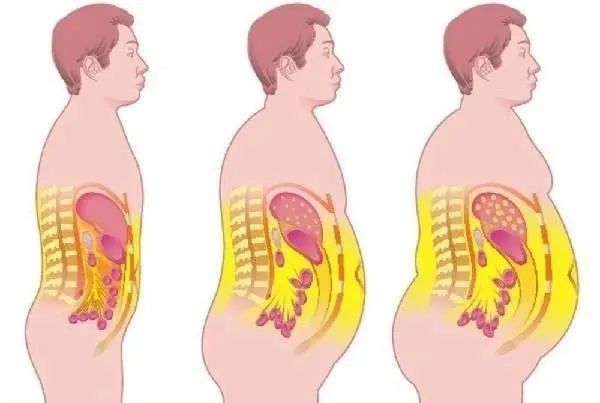 水果吃得多容易脂肪肝,脂肪肝吃哪些水果最好