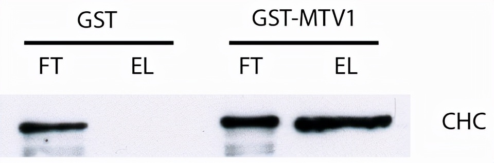 「开讲啦」拟南芥MTV1的pull-down实验