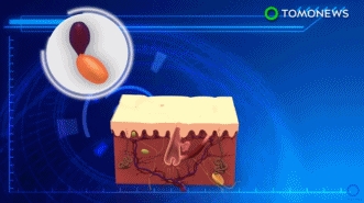 外国人脱发怎么治疗,脱发有没有治疗成功的