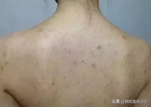 洗澡搓不到后背怎么办,洗澡怎么搓后背