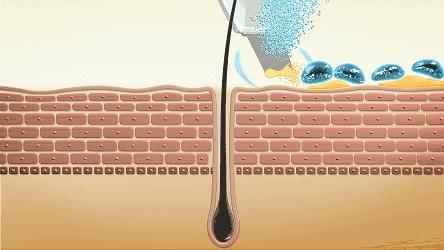 运动可以让脸上皮肤变好吗,脸上敷什么可以让皮肤变好