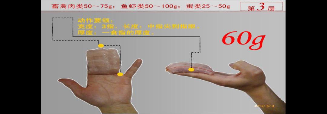 糖尿病合并尿酸高挂什么科,糖尿病合并高血脂治疗方案