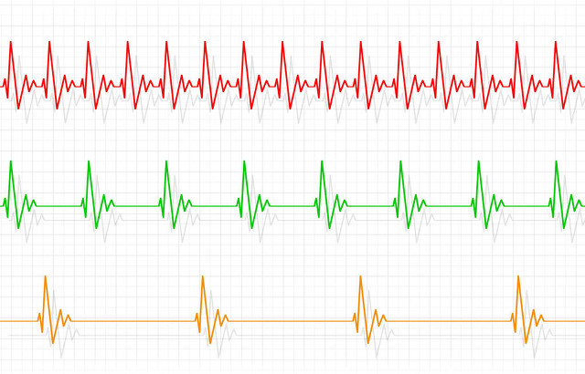心跳突然加快胸口砰砰的怎么办,心跳突然加快心里难受是什么病