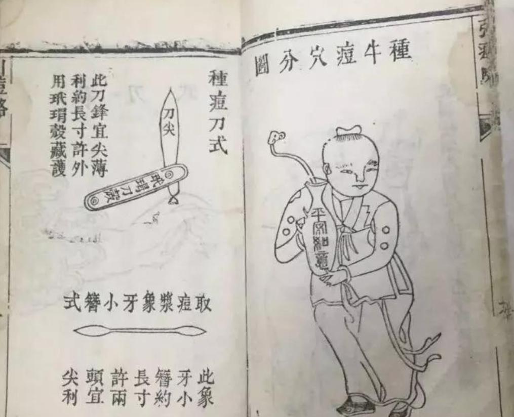 天花是怎么被消除的,天花怎么被根除的