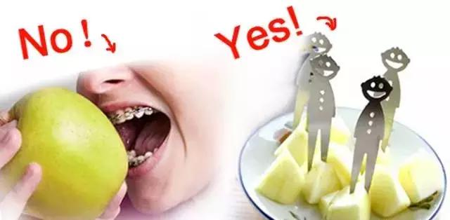 矫正牙齿是如何戴牙套的,矫正牙齿戴牙套需要注意事项