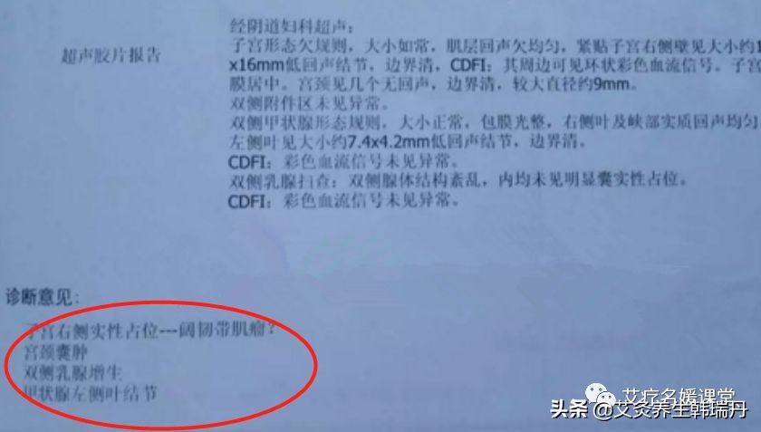 子宫肌瘤结节能治愈吗,中医消除肝结节最有效的方法