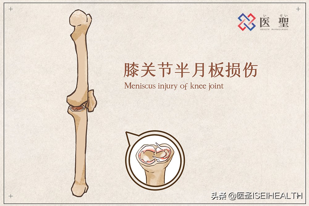 干细胞治疗膝关节炎,日本人怎样简单解决膝盖痛