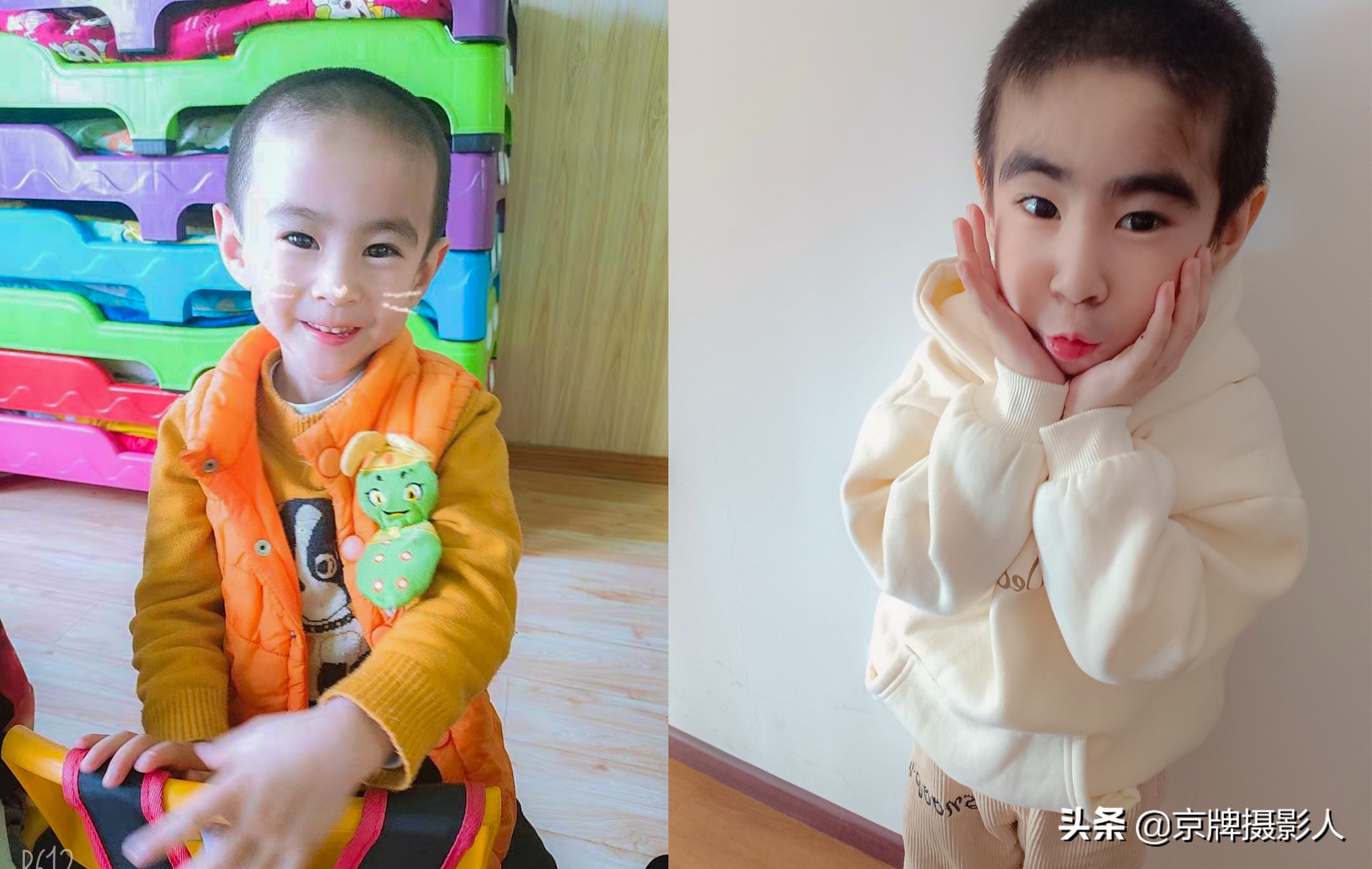 宝宝过敏挠痒,宝宝皮肤过敏需要即刻去医院吗