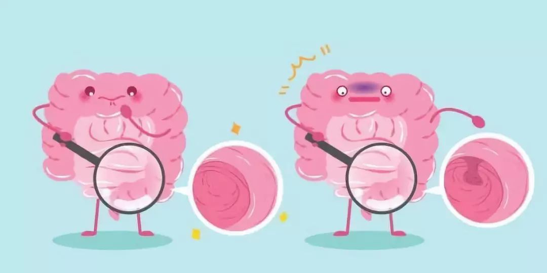 结肠癌入侵淋巴,结肠癌最佳终结者