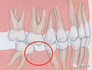 听说牙缝太大难看又露财，您给看看这牙缝还有救吗？