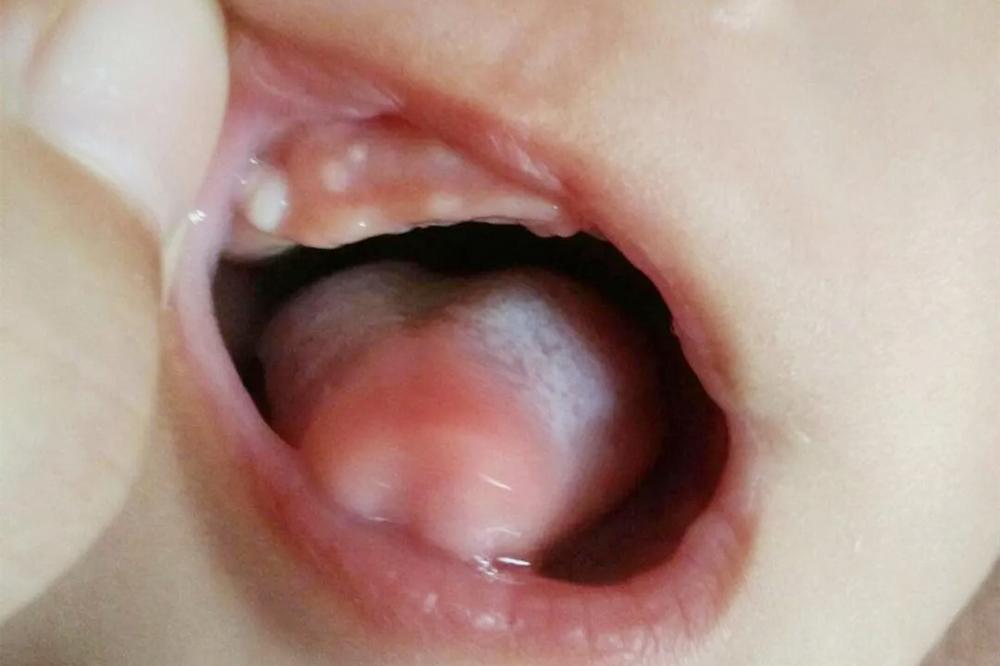 宝宝长牙顺序和注意事项,宝宝长牙顺序及征兆处理方法