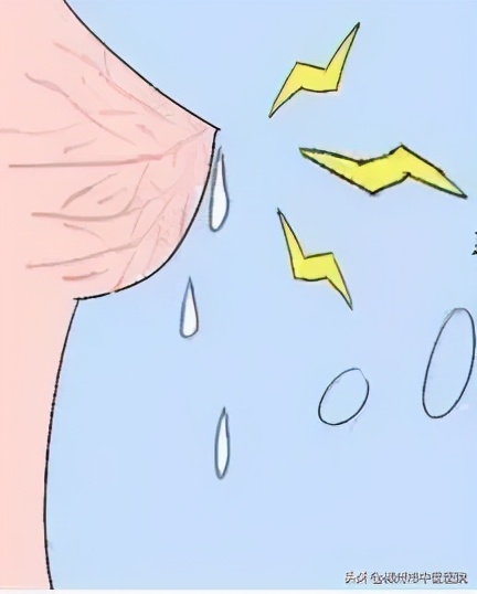 双侧乳头清水样溢液,乳头溢液的病因