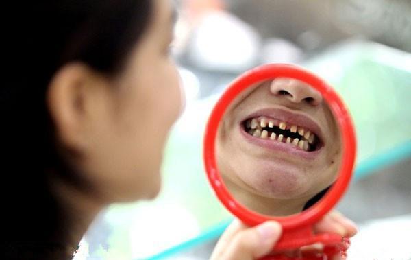 花2万美牙被骗，她一口好牙被打磨剩三分之一，变“怪物”？