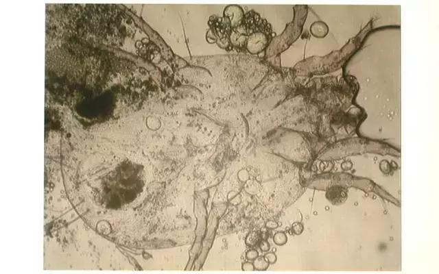 该如何不用晒就可以消除螨虫,不晒被子的除螨虫妙招