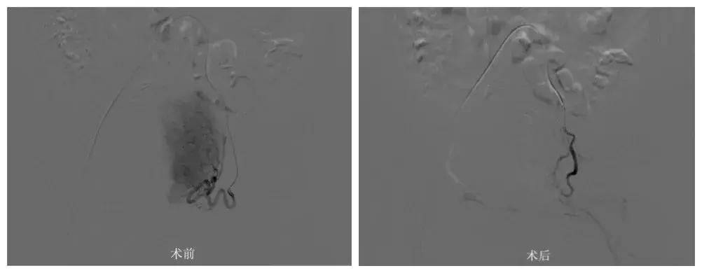 痛经不孕都是它惹的祸,原来痛经这样治疗才有效