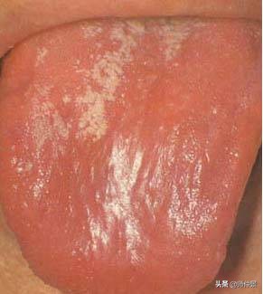 最实用的舌诊图六大舌象,舌诊深入学习书