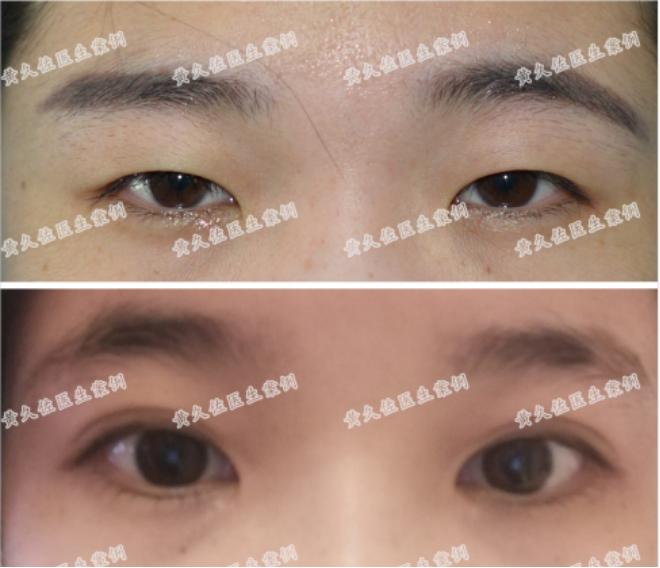 总觉得双眼无神,被说双眼无神