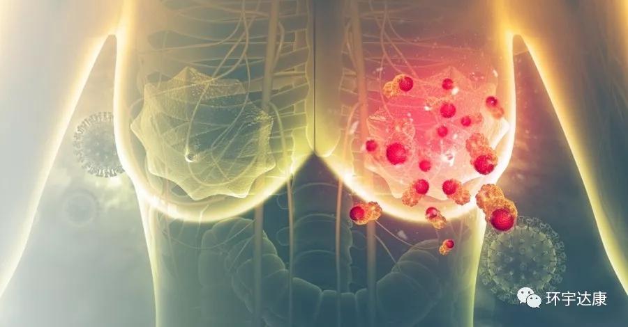 美国乳腺癌新药,将要上市的乳腺癌新药