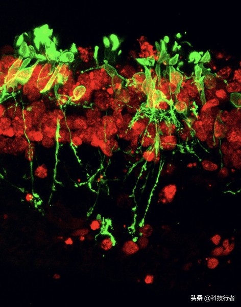 治疗视网膜色素变性的新研究成果,视网膜色素变性目前新型研究