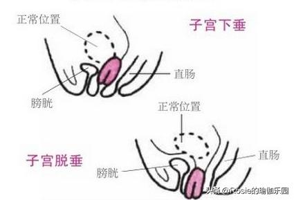 有一种痛堪比生孩子,有一种痛只有自己经历
