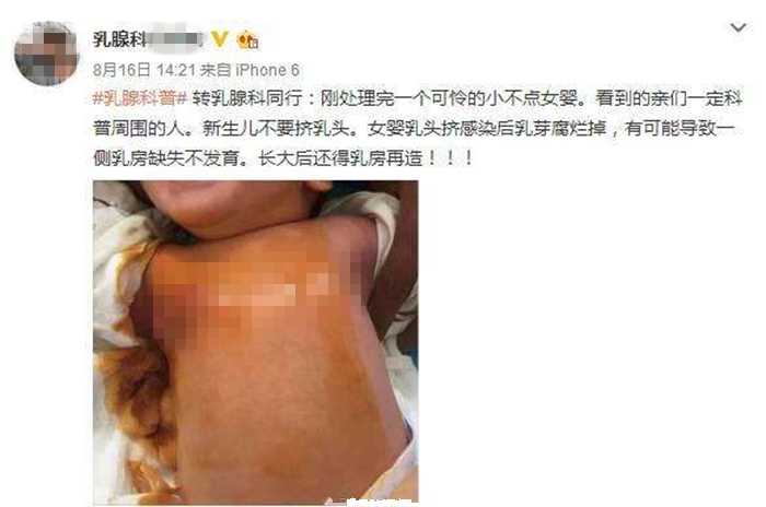 19岁少女乳头一直没长出来，不要听信“老人言”，这种错误犯不得
