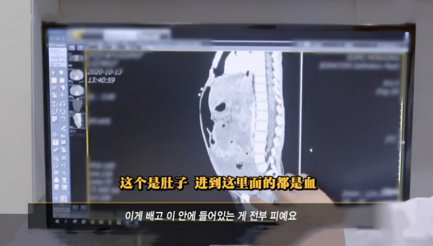 郑仁虐待事件,郑仁被养母录下800条虐待证据