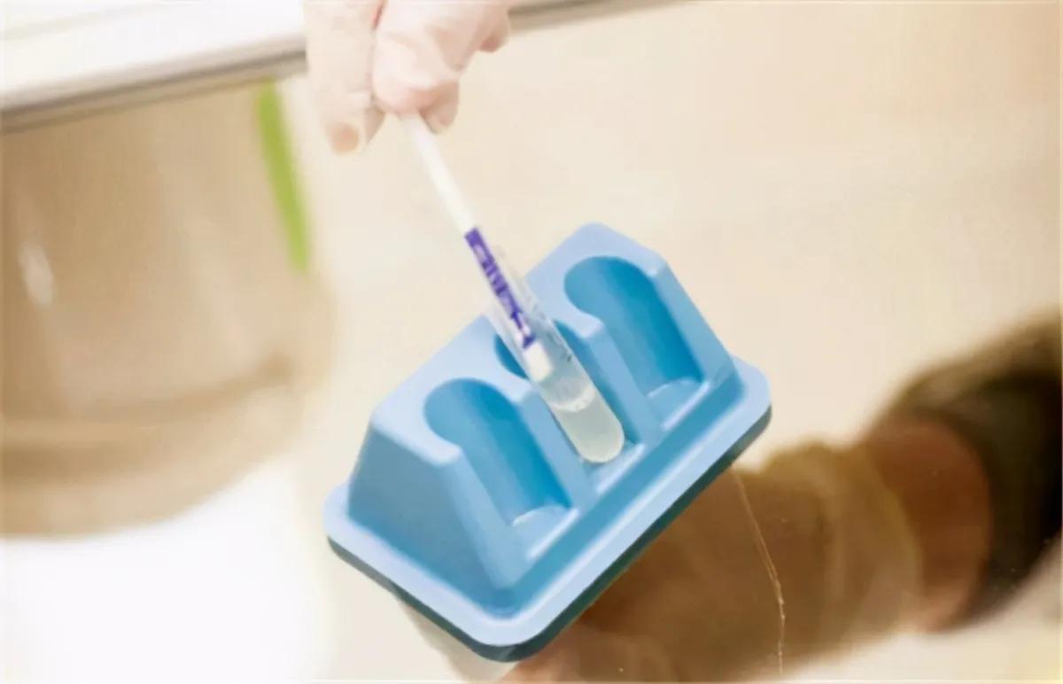 艾滋病同性传播率高的原因,艾滋病同性性传播概率多大