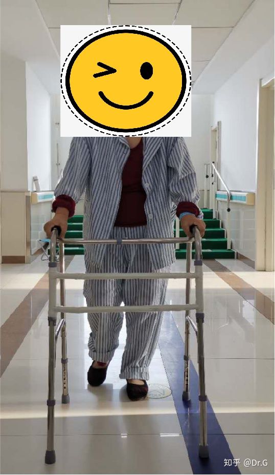 短时间用激素一定会股骨头坏死吗,没服过激素会股骨头坏死吗