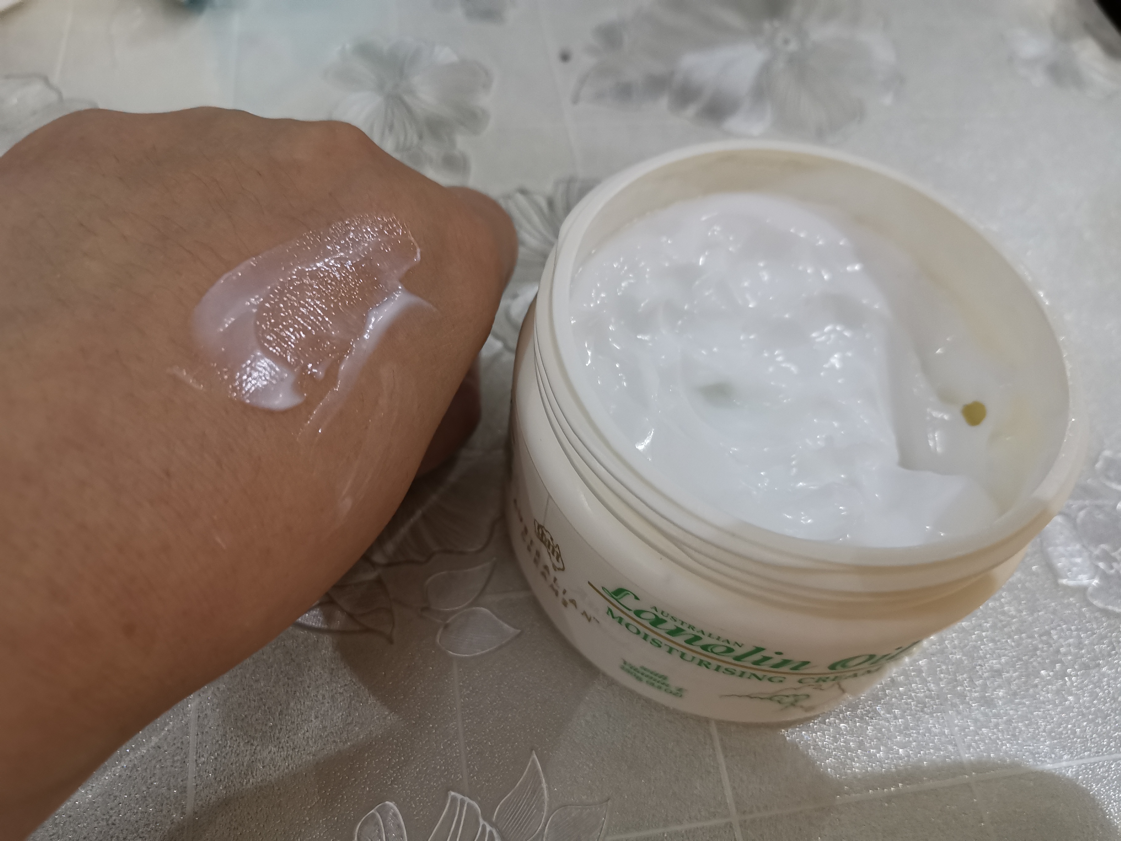 孩子湿疹皮肤干燥涂什么保湿霜,宝宝湿疹可以擦金银花多效面霜吗