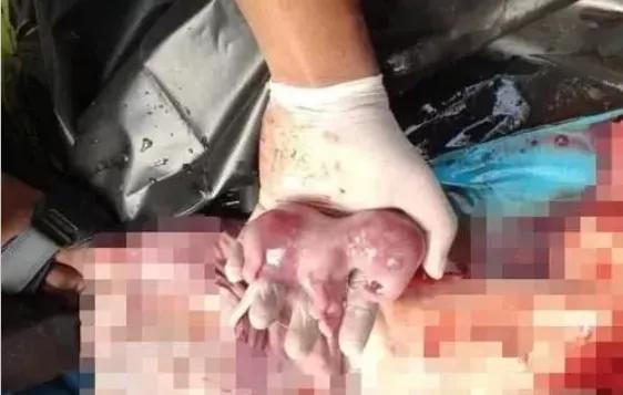 15岁怀孕的她，被骗吃下*药炸**，无辜去世：生而为人，有些人却不配