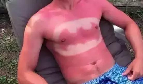 户外骑行最容易出问题是什么,骑行的危害怎么避免