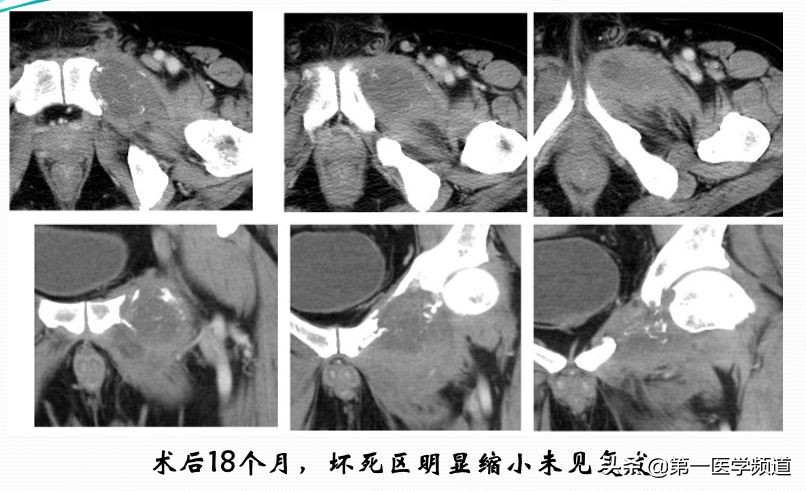 「医影传声」上海交通大学医学院附属瑞金医院卢湾分院放射科主任
