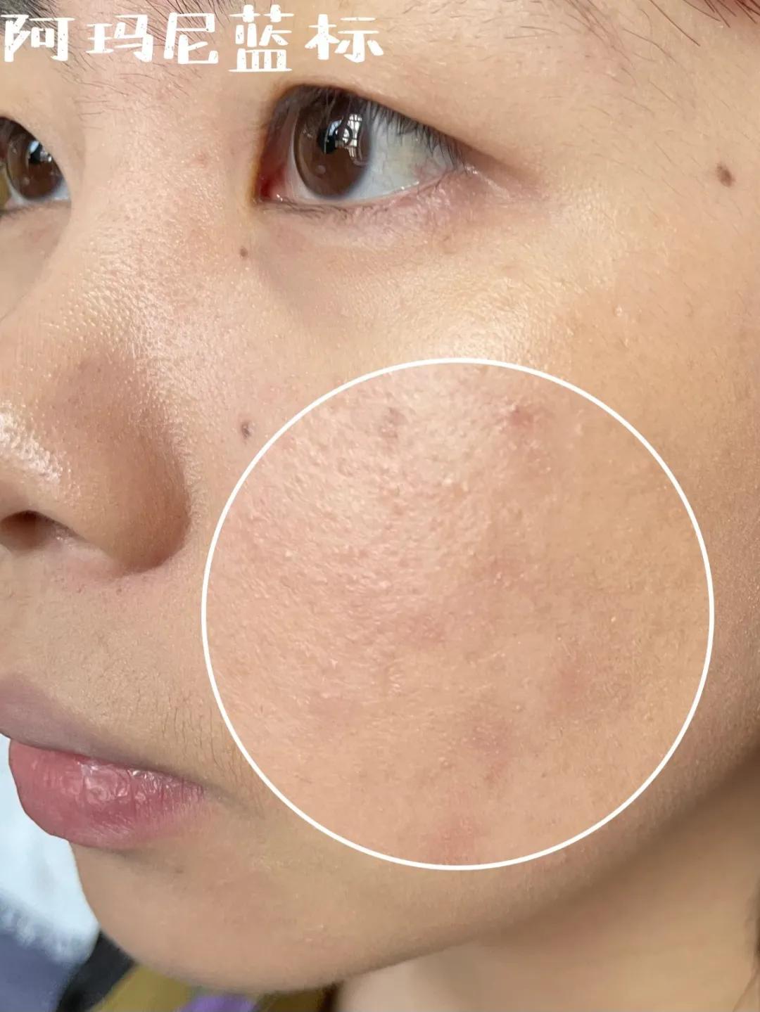 均价1k的贵妇粉底一定好用吗？今天我要说真话了