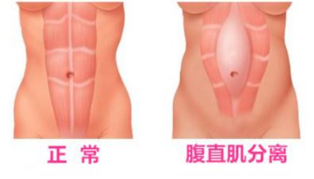 产后42天复查非常必要，宝妈们都需要做这些检查项目