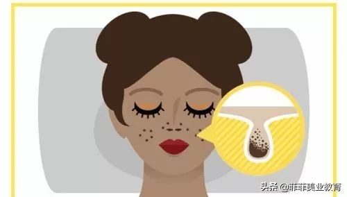 毛孔粗大怎么办教你快速收缩毛孔,毛孔粗大收缩毛孔最有效的方法