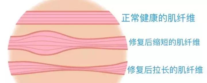 跑步放松肌肉方法筋膜枪,找到你科技是什么软件