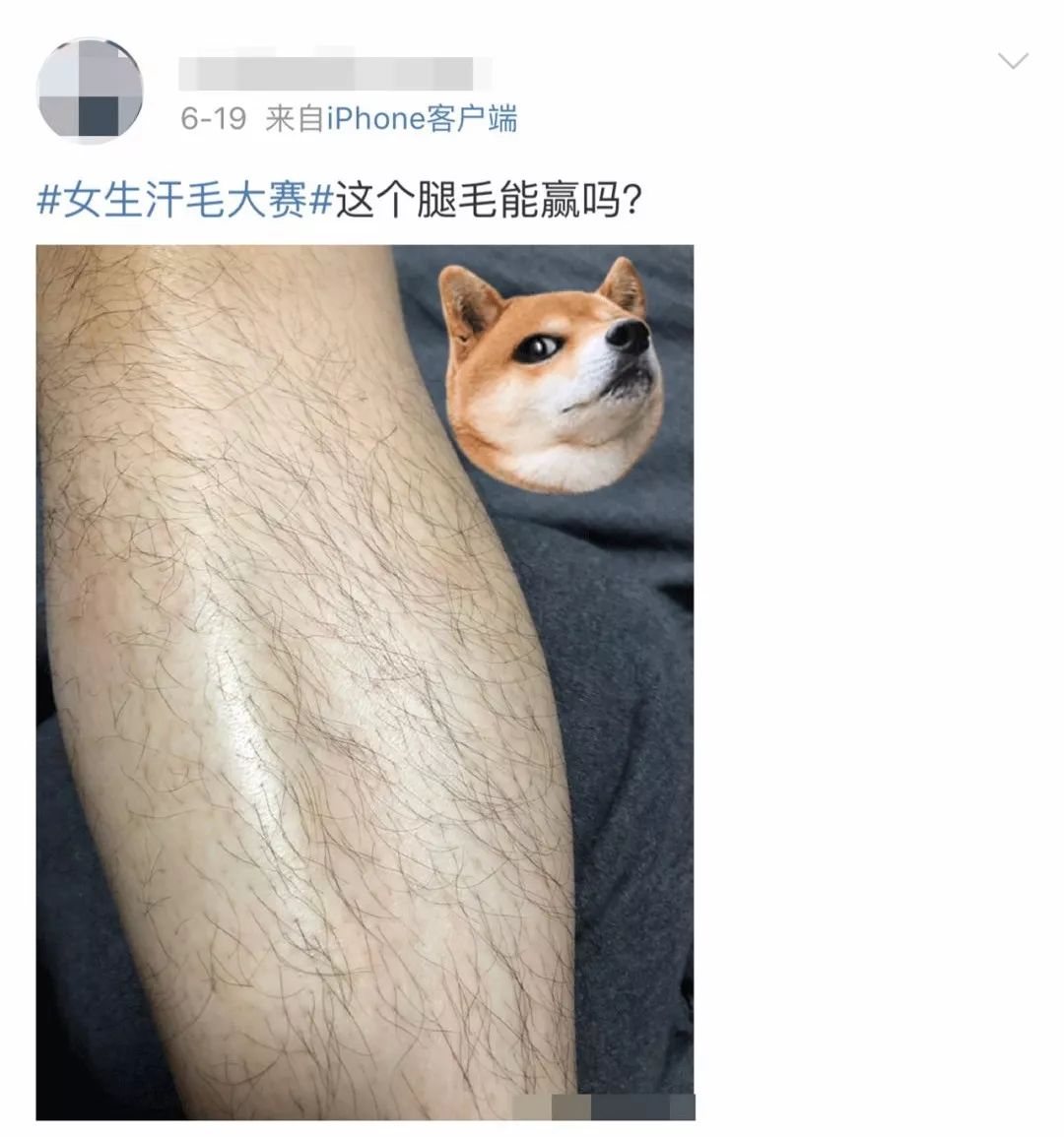 体毛脱毛的效果怎么样,天生体毛旺盛的人正常吗