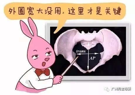 屁股大的女人生育好吗,屁股大的女生好生养