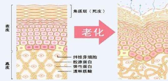 眼角皱巴巴的皱纹怎么办,眼角纹去皱最有效方法