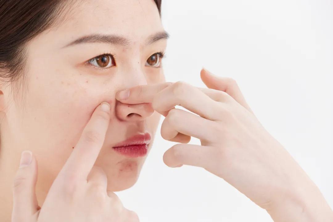 天气热皮肤干会长痘吗,混干长痘的人怎么护肤