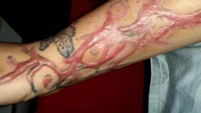 洗纹身真的有无痛的吗,洗纹身真的有无痛吗