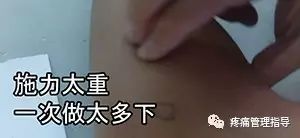 网球肘能自我恢复吗,网球肘病因的解剖学研究