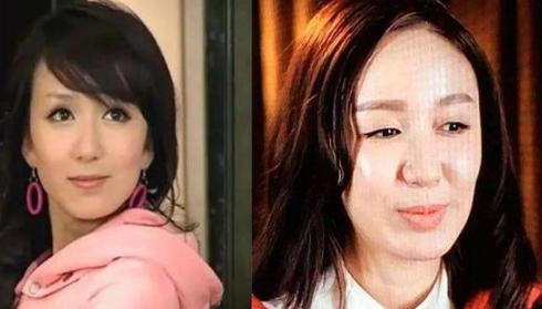 中庭太长显老,中庭过长会怎样