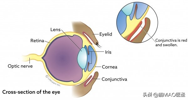猫咪支原体引起的结膜炎怎么治,猫支原体结膜炎一直没恢复