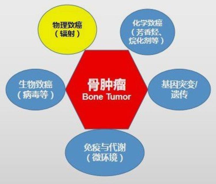 骨与软组织肿瘤的发病原因和预防