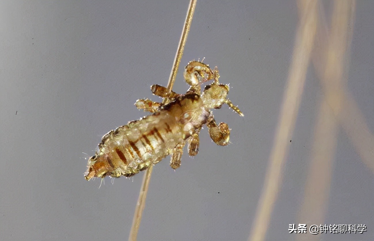 为什么虱子从21世纪就消失了,人类虱子的进化史