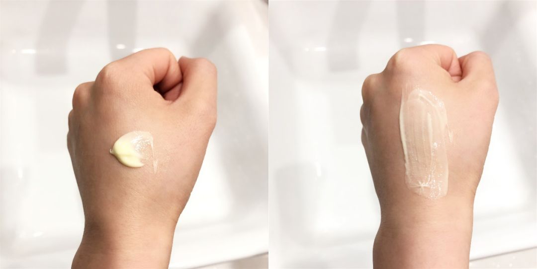 眼部常见问题有哪些,常见眼部问题