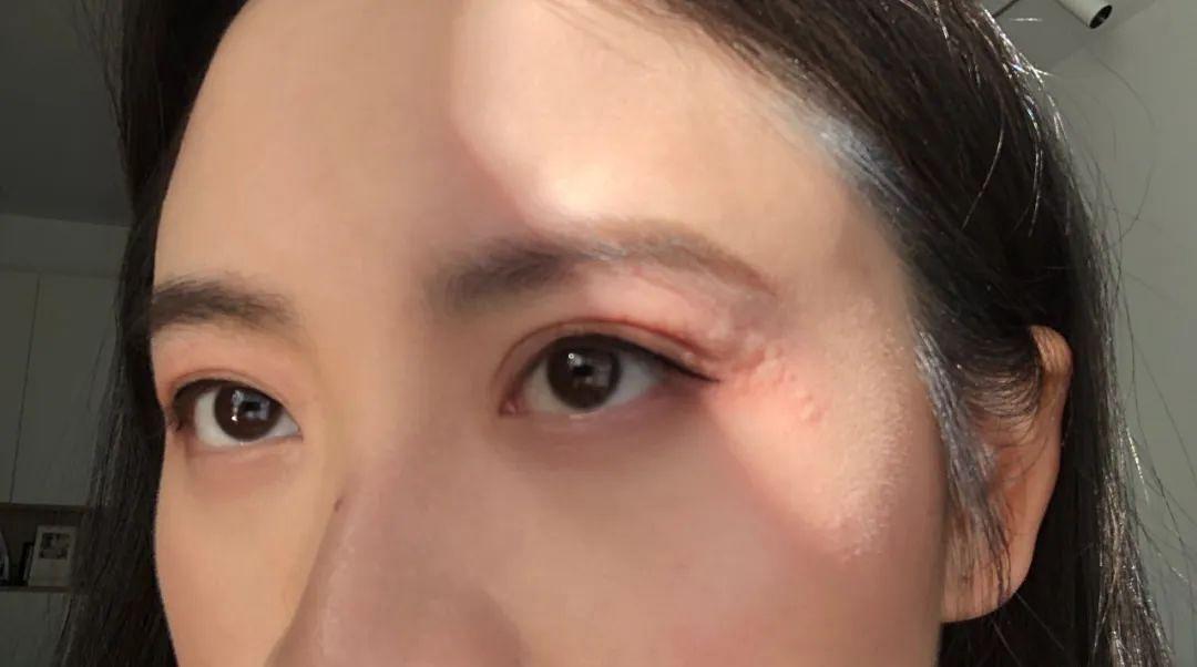 北京一女子4个月用空47次护肤品 (北京一女子用空47瓶护肤品)